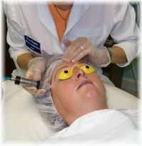Microdermabrasion